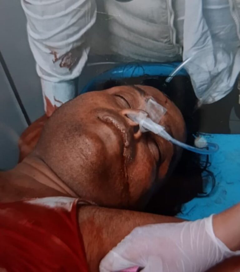 कानपुर में भाजपा नेता पर पुरानी रंजिश के चलते जानलेवा हमला, चाकू से वार के बाद गोली मारी; हालत नाजुक